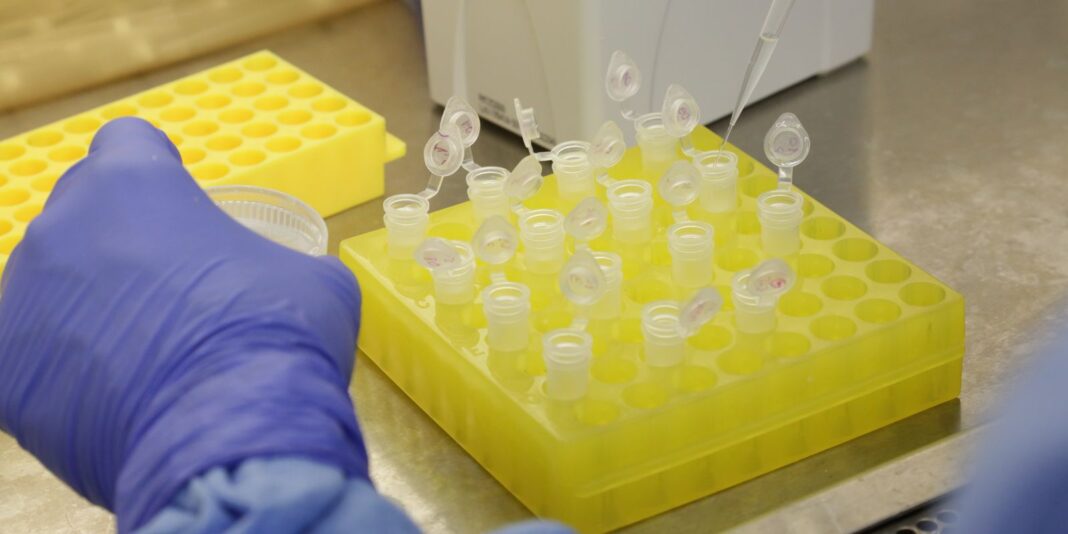 São Paulo registra segundo caso importado de sarampo