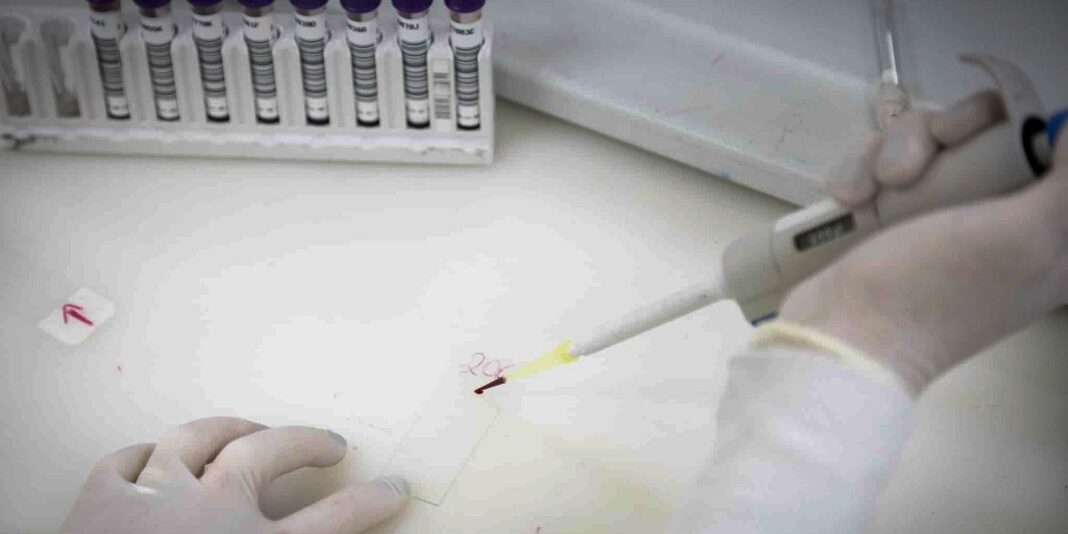 Paciente em SP com suspeita de ebola apresenta resultado positivo para meningite