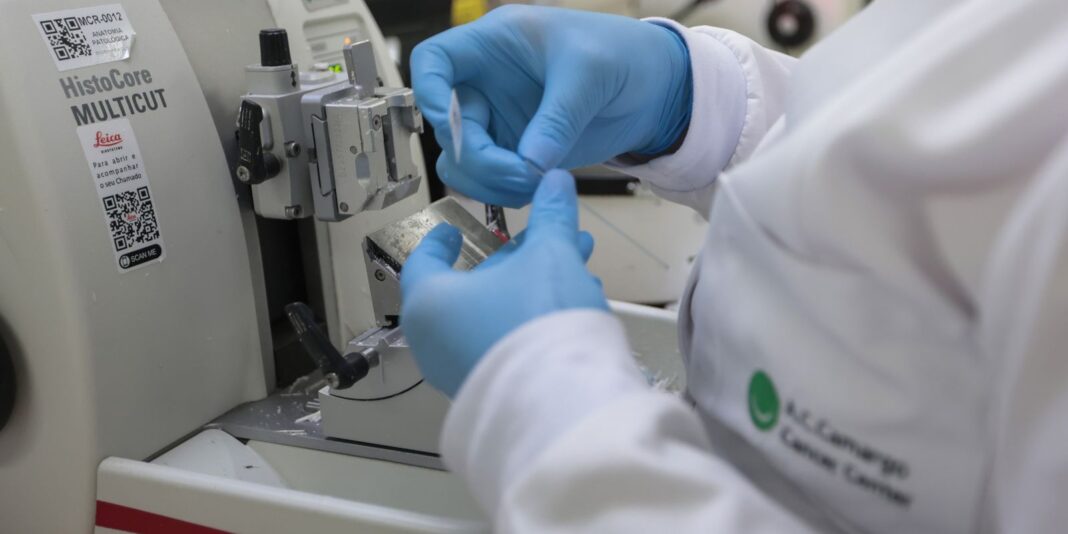 SUS incorpora nova terapia para adultos com leucemia mieloide