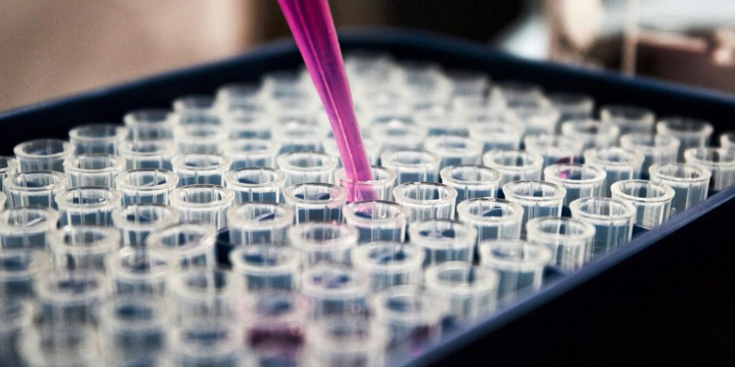 Diagnóstico precoce da AME é fundamental, afirma paciente