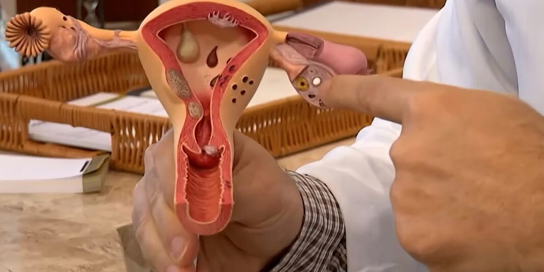 Chamada pública para pesquisas sobre endometriose é aberta