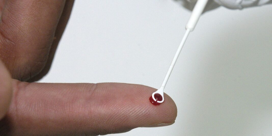 Fiji declara emergência nacional devido à alta taxa de HIV, com um caso a cada 60 pessoas