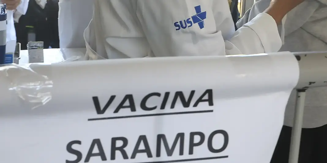 São Paulo registra novos casos de sarampo, totalizando 30 ocorrências