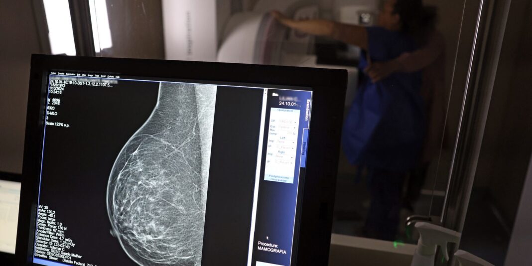 Médicos lançam guia para evitar recusa de mamografia digital